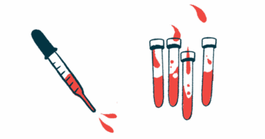 A dropper hovers alongside four vials filled with liquids.