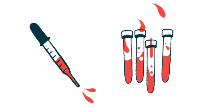A dropper hovers alongside four vials filled with liquids.