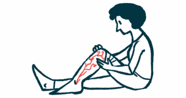 A woman sits on the floor, one leg bent at the knee as she inspects vascular damage.