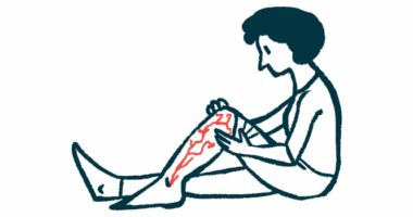 A woman sits on the floor, one leg bent at the knee as she inspects vascular damage.