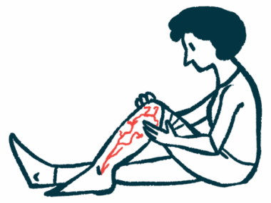 A woman sits on the floor, one leg bent at the knee as she inspects vascular damage.