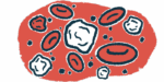 White blood cells are seen among red blood cells in this close-up illustration.