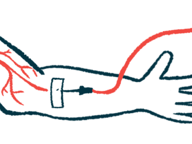 An intravenous injection into the bloodstream.