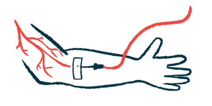 An intravenous injection into the bloodstream.